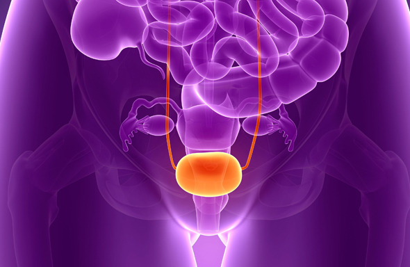 Bladder Cancer